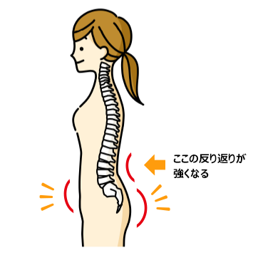 なぜ、出っ尻、お腹ぽっこりになるの？